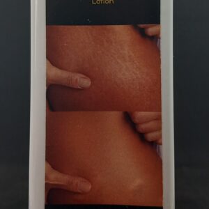 Dhin Dhin anti stretch marks lotion 250ml